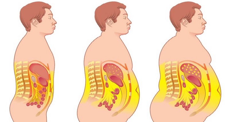 El peligro detrás de la grasa abdominal! Aquí 4 alimentos para