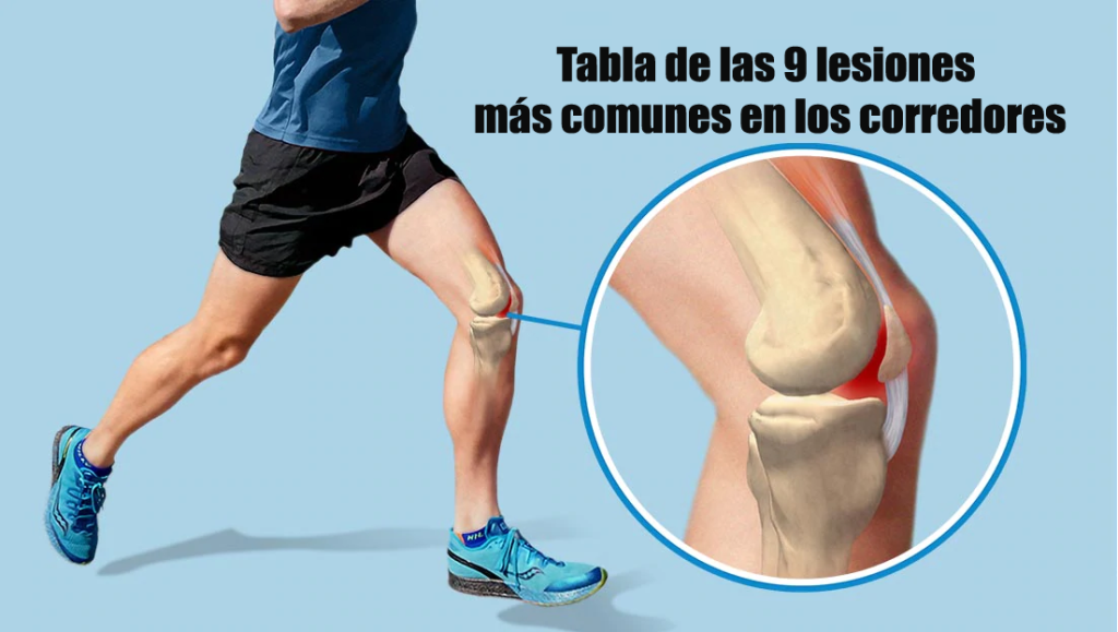 Tabla De Las 9 Lesiones Más Comunes En Los Corredores Marathon Ranking 8411